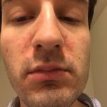 Before - March 2016 - 1